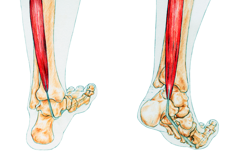 Te strakke buigpees Te strakke buigpees