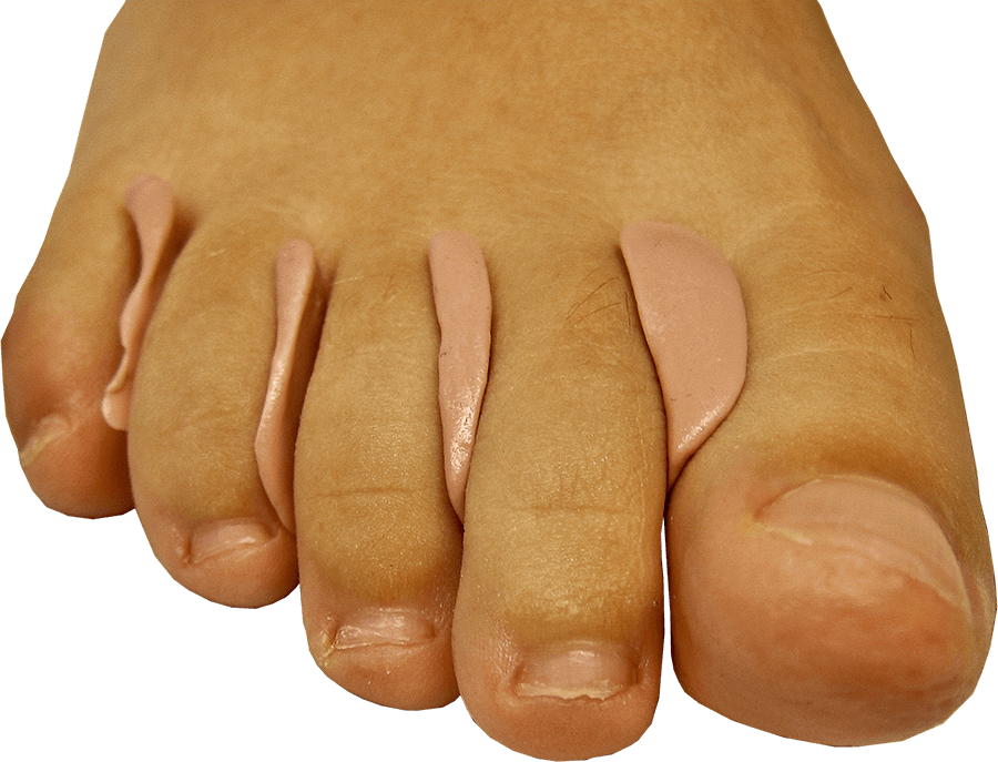 Siliconen orthese om de tenen te beschermen Siliconen orthese om de tenen te beschermen